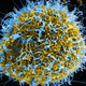Illustration for article titled How Ebola Can Still Be Very Infectious (Without Being Very Contagious)